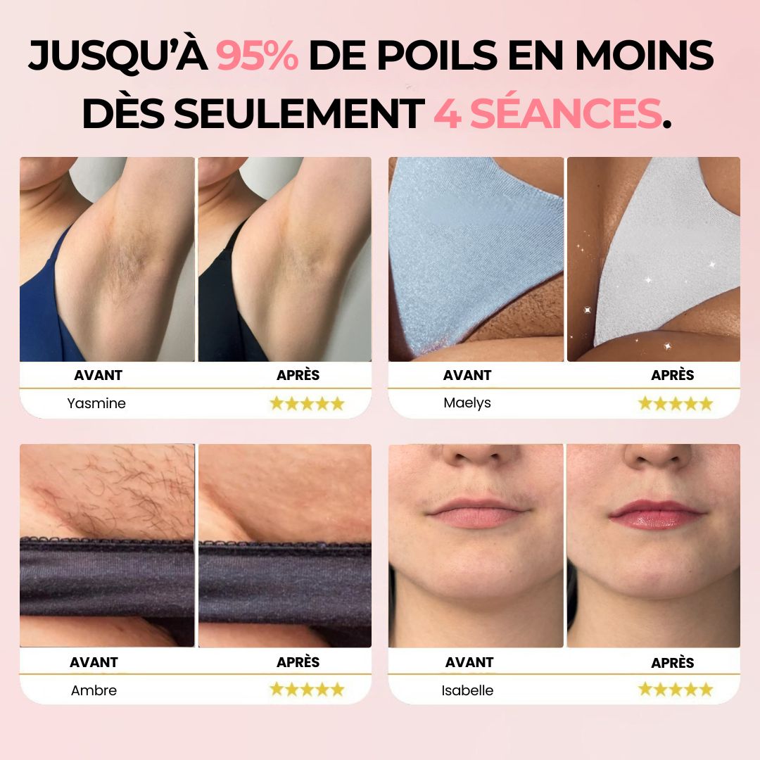 IPL Pulse • Épilateur à Lumière Pulsée